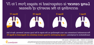 This animated graphic explains the differences between the two main forms of lung cancer, and how the two main forms of lung cancer are staged.
